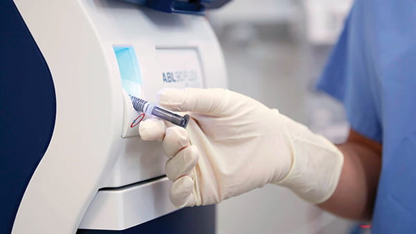 Automatikus keverés az ABL90 FLEX PLUS analizátoron